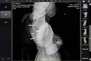 radiografia1