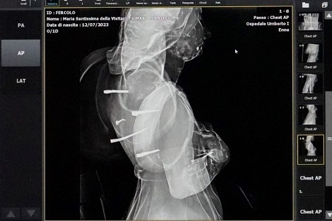 radiografia1